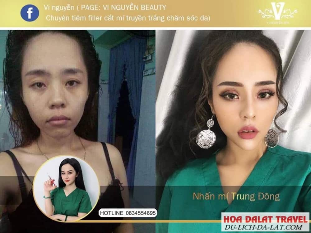 Vi Nguyễn Beauty Spa Đà Lạt
