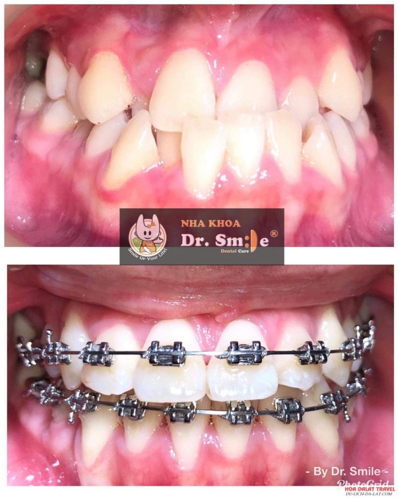 Dr. Smile Dental Care